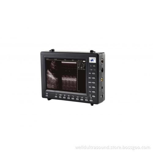 Palmsize Full Digital Ultrasound Diagnostic System